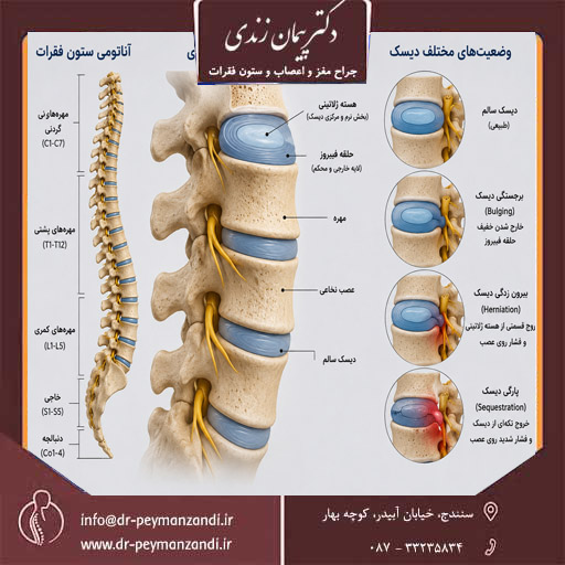آناتومی دیسک کمر و ستون فقرات